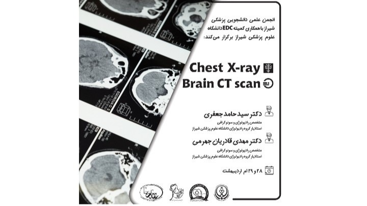 وبینار آموزشی Brain CT و Chest X-Ray